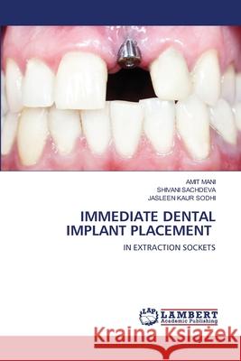 Immediate Dental Implant Placement Amit Mani Shivani Sachdeva Jasleen Kaur Sodhi 9786203202847