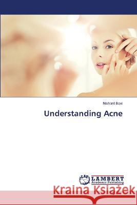 Understanding Acne Nishant Baxi 9786206148791