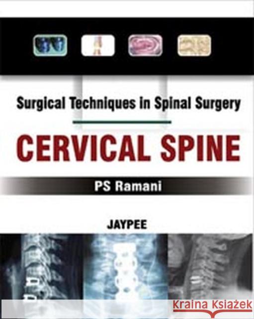 Surgical Techniques in Spinal Surgery: Cervical Spine P.S. Ramani   9788184487824 Jaypee Brothers Medical Publishers