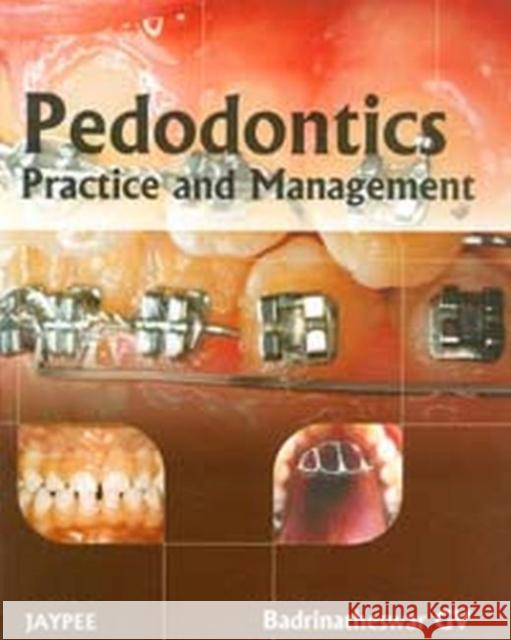 Pedodontics: Practice and Management Badrinatheswar, Gv 9788184489163 Jaypee Brothers Medical Publishers