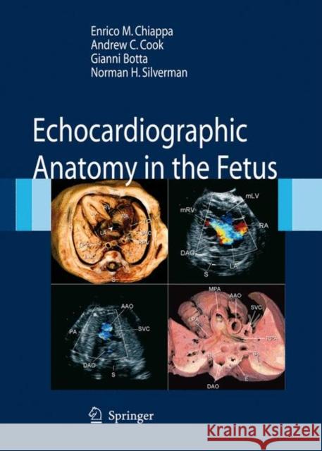 Echocardiographic Anatomy in the Fetus [With DVD] Chiappa, Enrico 9788847005723 Springer