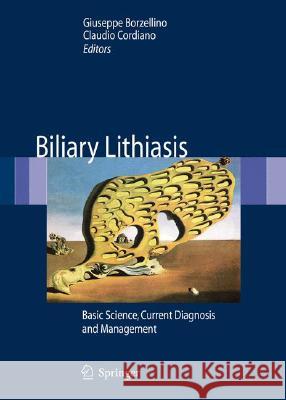 Biliary Lithiasis: Basic Science, Current Diagnosis and Management Borzellino, Giuseppe 9788847007628 Not Avail