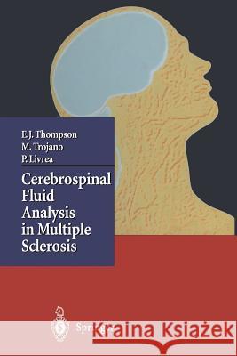 Cerebrospinal Fluid Analysis in Multiple Sclerosis Paolo Livrea                             E. J. Thompson                           Maria Trojano 9788847022072 Springer