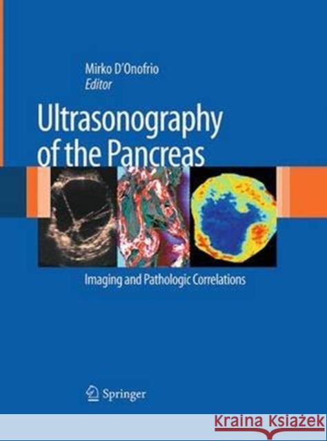 Ultrasonography of the Pancreas: Imaging and Pathologic Correlations D'Onofrio, Mirko 9788847039087 Springer