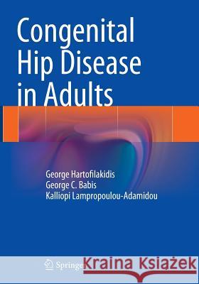 Congenital Hip Disease in Adults George Hartofilakidis George C. Babis Kalliopi Lampropoulou-Adamidou 9788847058774 Springer