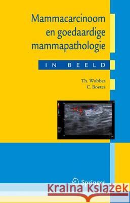 Mammacarcinoom en goedaardige mammapathologie in beeld T. Wobbes, C. Boetes 9789031362622 Bohn Stafleu van Loghum