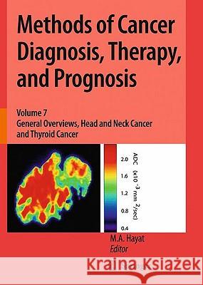 Methods of Cancer Diagnosis, Therapy, and Prognosis: General Overviews, Head and Neck Cancer and Thyroid Cancer Hayat, M. A. 9789048131853 Springer