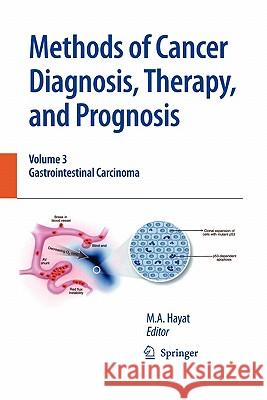 Methods of Cancer Diagnosis, Therapy and Prognosis: Gastrointestinal Cancer Hayat, M. A. 9789048180219 Springer