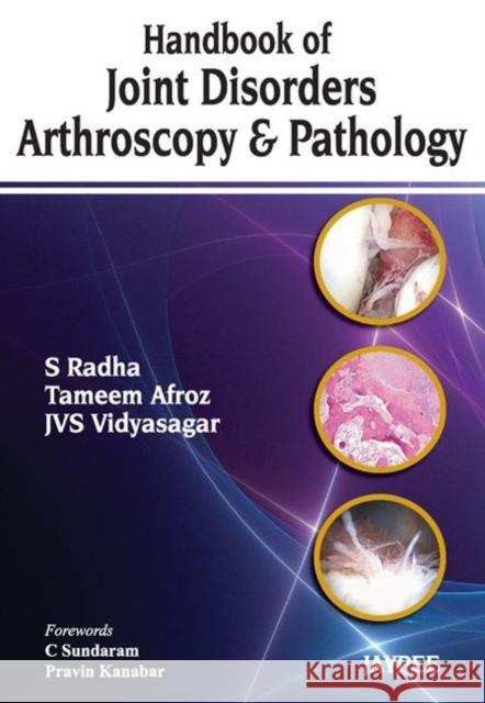 Handbook of Joint Disorders Arthroscopy & Pathology S Radha 9789350257234 0
