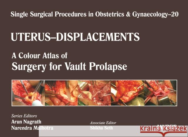 Single Surgical Procedures in Obstetrics and Gynaecology - Volume 20 - Uterus - Displacements: A Colour Atlas of Surgery for Vault Prolapse Nagrath, Arun 9789350257920 Jaypee