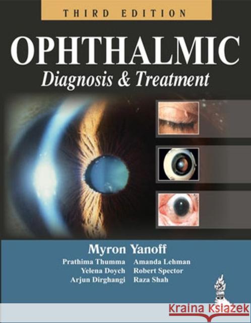 Ophthalmic Diagnosis and Treatment Yanoff, Myron 9789350259528 Jp Medical Ltd