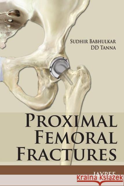 Proximal Femoral Fractures Sudhir Babhulkar 9789350903711 Jp Medical Ltd