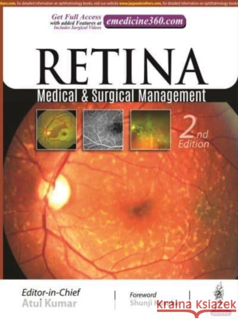 Retina: Medical & Surgical Management Atul Kumar   9789354652202 Jaypee Brothers Medical Publishers