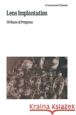 Lens Implantation: 30 Years of Progress Leonard, P. 9789400980204 Springer