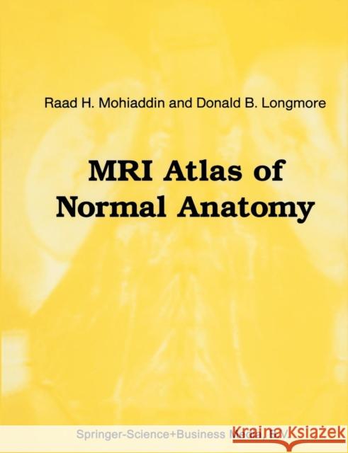 MRI Atlas of Normal Anatomy Raad H. Mohiaddin D. B. Longmore Raad H 9789401053297 Springer