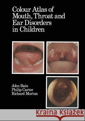 Colour Atlas of Mouth, Throat and Ear Disorders in Children D. J. Bain R. a. Morton Philip Carter 9789401086622 Springer