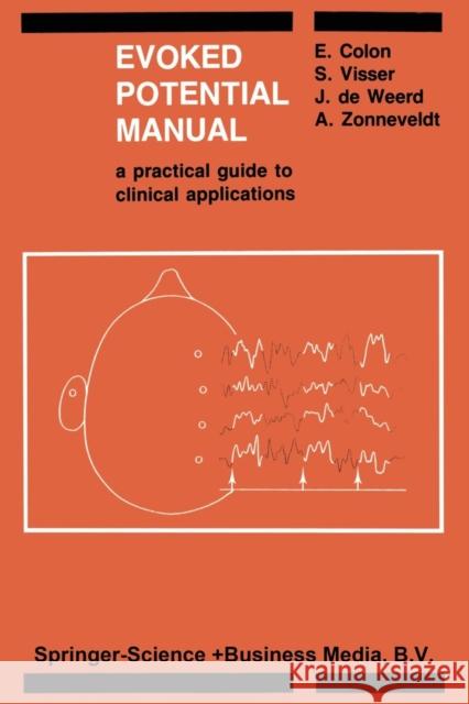 Evoked Potential Manual: A Practical Guide to Clinical Applications Colon, E. 9789401715010 Springer
