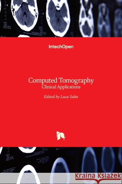 Computed Tomography: Clinical Applications Luca Saba 9789533073781 Intechopen