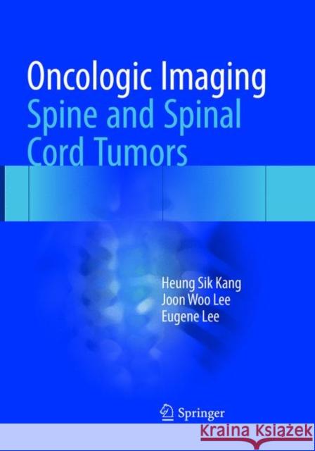 Oncologic Imaging: Spine and Spinal Cord Tumors Kang, Heung Sik; Lee, Joon Woo; Lee, Eugene 9789811357046 Springer