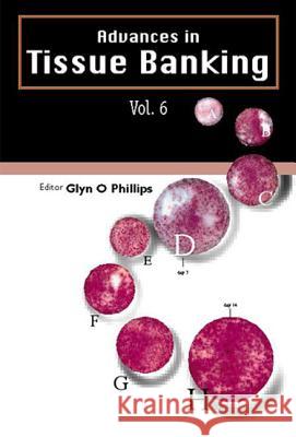 Advances in Tissue Banking, Vol. 6 Glyn O. Phillips 9789812380883 World Scientific Publishing Company