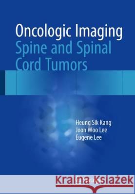 Oncologic Imaging: Spine and Spinal Cord Tumors Heung Sik Kang Joon Woo Lee Eugene Lee 9789812876997 Springer
