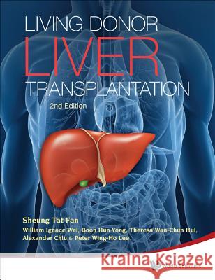 Living Donor Liver Transplantation (2nd Edition) Sheung Tat Fan Peter Wing-Ho Lee William I. Wei 9789814329750 World Scientific Publishing Company