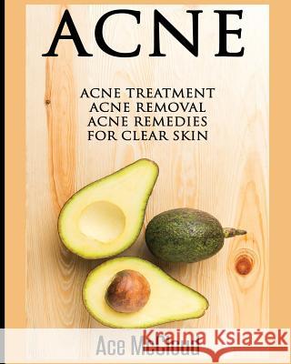 Acne: Acne Treatment: Acne Removal: Acne Remedies For Clear Skin McCloud, Ace 9781640480018 Pro Mastery Publishing - książka