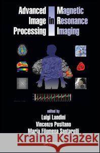 Advanced Image Processing in Magnetic Resonance Imaging Luigi Landini Vincenzo Positano Maria Santarelli 9780824725426 CRC Press - książka