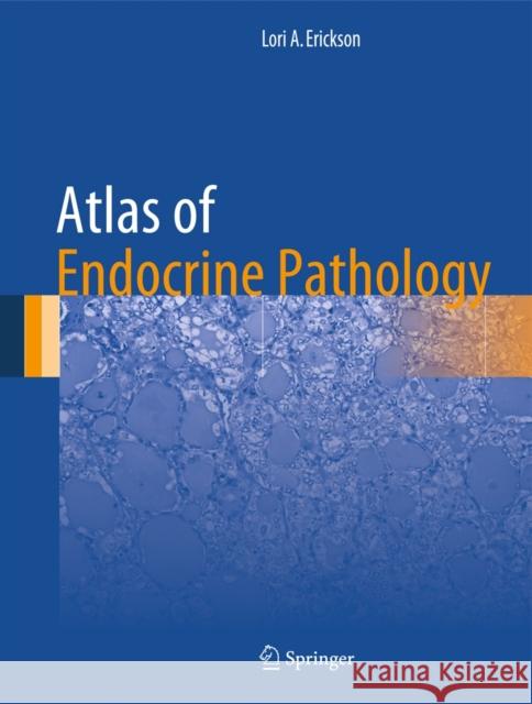 Atlas of Endocrine Pathology Lori A. Erickson 9781493904426 Springer - książka