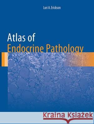 Atlas of Endocrine Pathology Lori A. Erickson 9781493954322 Springer - książka