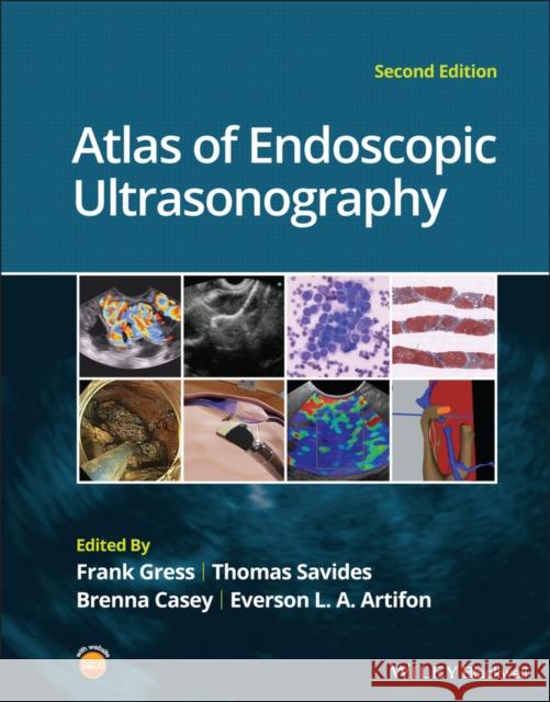 Atlas of Endoscopic Ultrasonography Frank G. Gress Thomas J. Savides Brenna Casey 9781119523000 Wiley-Blackwell - książka