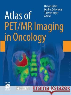 Atlas of Pet/MR Imaging in Oncology Ratib, Osman 9783662509951 Springer - książka