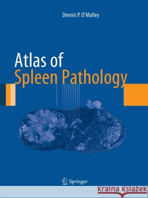 Atlas of Spleen Pathology Dennis P. O'Malley 9781493952335 Springer - książka