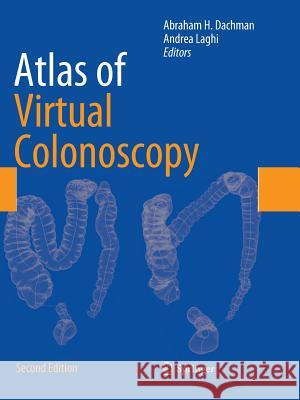 Atlas of Virtual Colonoscopy Abraham H. Dachman Andrea Laghi 9781493938230 Springer - książka