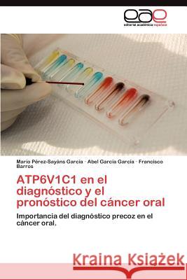 ATP6V1C1 en el diagnóstico y el pronóstico del cáncer oral Pérez-Sayáns García Mario 9783845491127 Editorial Acad Mica Espa Ola - książka