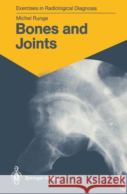 Bones and Joints: 170 Radiological Exercises for Students and Practitioners Michel Runge Marie-Therese Wackenheim 9783540165446 Springer - książka