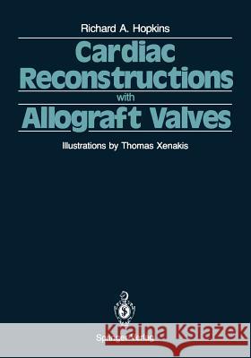 Cardiac Reconstructions with Allograft Valves Richard A. Hopkins Thomas Xenakis 9781461281597 Springer - książka