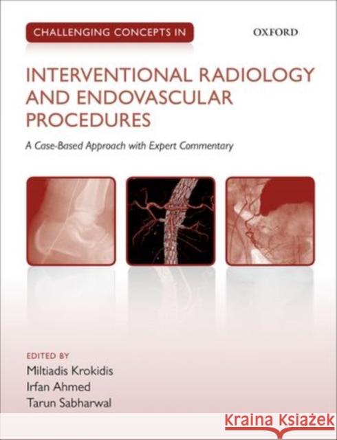 Challenging Concepts in Interventional Radiology Miltiadis Krokidis Irfan Ahmed Tarun Sabharwal 9780199664382 Oxford University Press, USA - książka