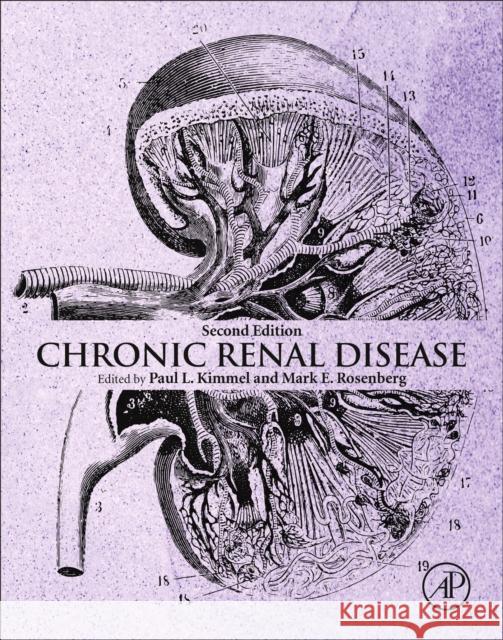 Chronic Renal Disease Paul L. Kimmel Mark E. Rosenberg 9780128158760 Academic Press - książka