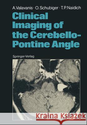 Clinical Imaging of the Cerebello-Pontine Angle Anton Valavanis Othmar Schubiger Thomas P. Naidich 9783642712067 Springer - książka