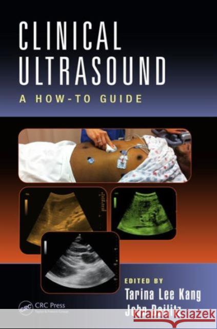 Clinical Ultrasound: A How-To Guide Tarina Lee Kang Peter Rosen John Bailitz 9781482221404 CRC Press - książka