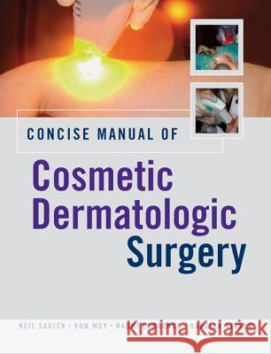 Concise Manual of Cosmetic Dermatologic Surgery Neil Sadick Ron Moy Naomi Lawrence 9780071453660 McGraw-Hill Professional Publishing - książka