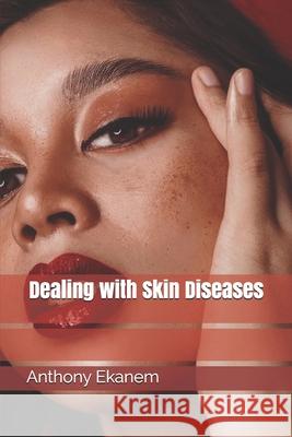 Dealing with Skin Diseases Anthony Ekanem 9781541399297 Createspace Independent Publishing Platform - książka