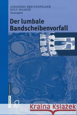 Der Lumbale Bandscheibenvorfall Breitenfelder, J. 9783798514218 Steinkopff-Verlag Darmstadt - książka