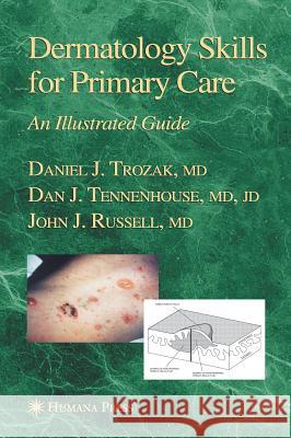 Dermatology Skills for Primary Care: An Illustrated Guide Trozak, Daniel J. 9781588294890 Humana Press - książka