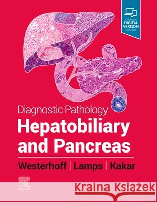 Diagnostic Pathology: Hepatobiliary and Pancreas Laura W. Lamps 9780323776202 Elsevier - książka