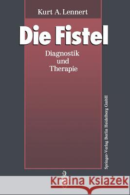 Die Fistel: Diagnostik Und Therapie Lennert, Kurt A. 9783662008386 Springer - książka
