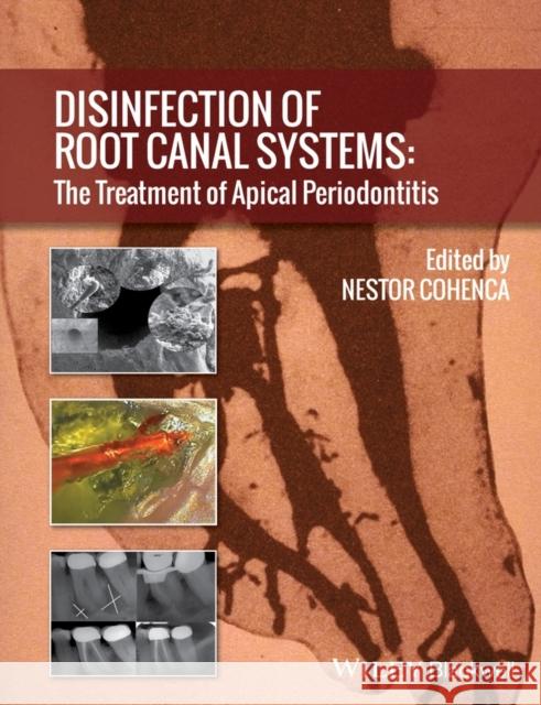Disinfection of Root Canal Systems: The Treatment of Apical Periodontitis Cohenca, Nestor 9781118367681 John Wiley & Sons - książka