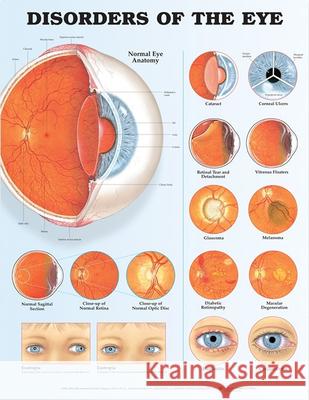 Disorders of the Eye Anatomical Chart   9781587799242  - książka