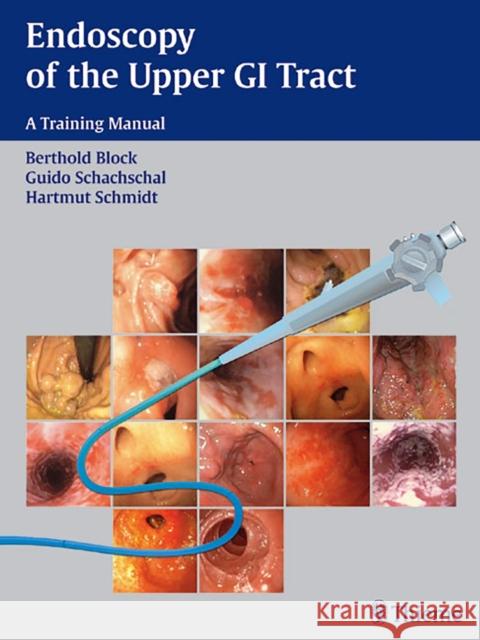 Endoscopy of the Upper GI Tract: A Training Manual Block, Berthold 9783131367310 Thieme Publishing Group - książka